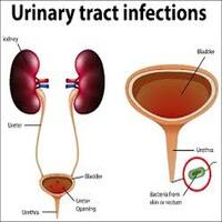 Urinary Tract Infection (UTI)