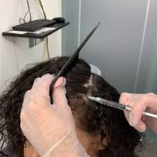prp treatment