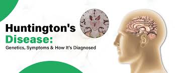 huntington's disease
